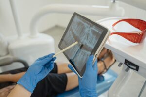 Детальніше про статтю Рентгенографія: невід’ємний інструмент сучасної діагностики